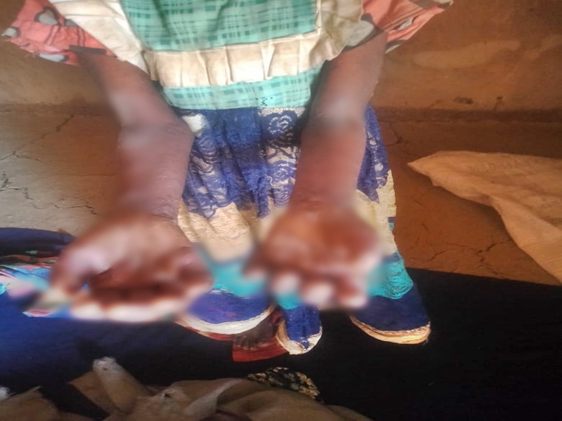 Contaminated Water Behind Skin Disease Outbreak In MP's Betul, Says Digvijaya Singh